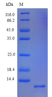 Recombinant Human C-X-C motif chemokine 5(CXCL5),partial(Active)