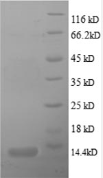 Recombinant Human C-X-C motif chemokine 5(CXCL5),partial