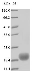 Recombinant Human CAMPATH-1 antigen (CD52)