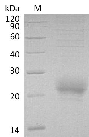 Recombinant Human CD160 antigen(CD160) (Active)
