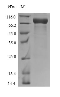 Recombinant Human CD226 antigen(CD226),partial (Active)