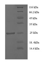 Recombinant Human CD81 antigen(CD81),partial
