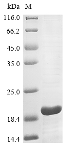 Recombinant Human CMRF35-like molecule 7(CD300LB),partial