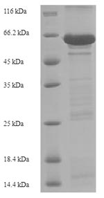 Recombinant Human Cadherin-1(CDH1),partial