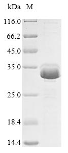 Recombinant Human Calmodulin(CALM1)