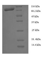Recombinant Human Calpain-1 catalytic subunit(CAPN1)