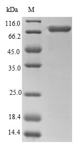 Recombinant Human Calreticulin (CALR)