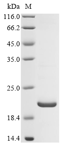 Recombinant Human Carbamoyl-phosphate synthase [ammonia], mitochondrial(CPS1),partial