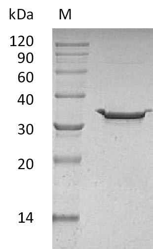 Recombinant Human Carbonic anhydrase 5B, mitochondrial(CA5B) (Active)