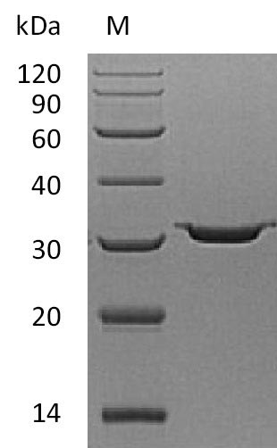 Recombinant Human Carbonic anhydrase 7(CA7) (Active)