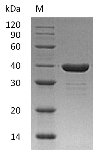 Recombinant Human Carbonic anhydrase-related protein(CA8),partial (Active)