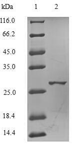 Recombinant Human Catechol O-methyltransferase(COMT),partial