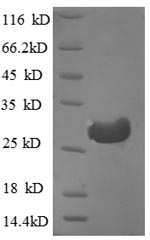 Recombinant Human Cathepsin F protein(CTSF),partial