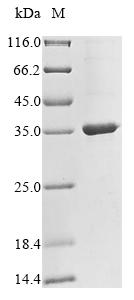 Recombinant Human Ceruloplasmin(CP),partial