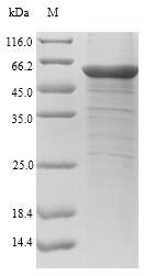 Recombinant Human Chitinase-3-like protein 1(CHI3L1)