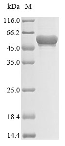 Recombinant Human Chitinase-3-like protein 2(CHI3L2) 