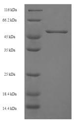 Recombinant Human Chitinase domain-containing protein 1(CHID1)