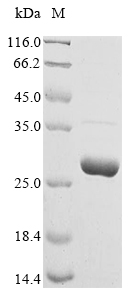 Recombinant Human Chorionic somatomammotropin hormone protein(CSH1)