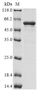 Recombinant Human Chromobox protein homolog 8(CBX8)