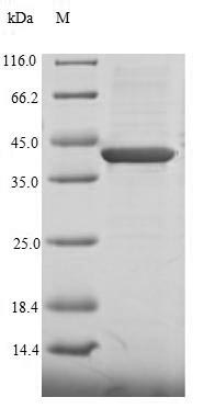 Recombinant Human Chromodomain-helicase-DNA-binding protein 1-like(CHD1L),partial