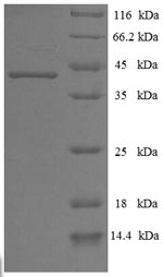 Recombinant Human Chymotrypsin-like elastase family member 3A(CELA3A)