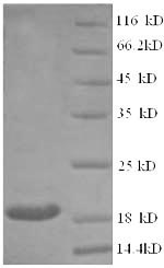 Recombinant Human Clathrin heavy chain 2(CLTCL1) ,partial