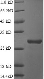 Recombinant Human Clusterin(CLU) ,partial