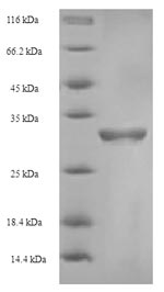 Recombinant Human Coagulation factor V(F5),partial