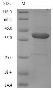 Recombinant Human Coagulation factor XI(F11),partial