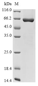 Recombinant Human Coiled-coil domain-containing protein 112(CCDC112)