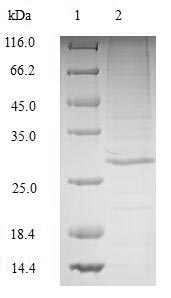 Recombinant Human Complement C1q tumor necrosis factor-related protein 3(C1QTNF3)