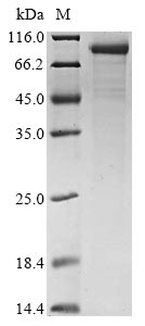 Recombinant Human Complement C1s subcomponent(C1S)