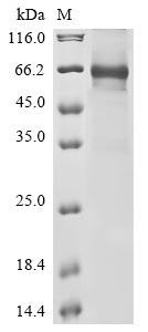 Recombinant Human Complement component C8 beta chain(C8B)