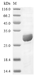 Recombinant Human Complement component C8 gamma chain(C8G)