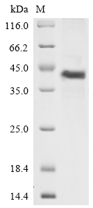 Recombinant Human Complement decay-accelerating factor(CD55),partial