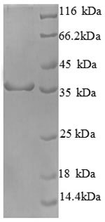 Recombinant Human Cyclin-dependent kinase 4(CDK4)