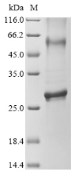 Recombinant Human Cyclin-dependent kinase 5 activator 1(CDK5R1),partial