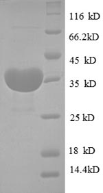 Recombinant Human Cystatin-B(CSTB)