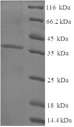 Recombinant Human Cysteine and glycine-rich protein 3(CSRP3)