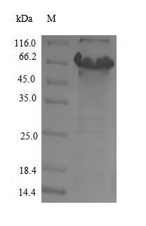 Recombinant Human Cytochrome P450 11B2, mitochondrial(CYP11B2)