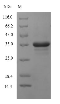 Recombinant Human Cytochrome b-245 heavy chain(CYBB),partial
