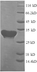 Recombinant Human Cytochrome c oxidase subunit 4 isoform 1, mitochondrial(COX4I1)