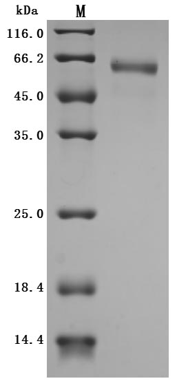 Recombinant Human Cytokine receptor common subunit beta(CSF2RB),partial (Active)