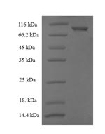 Recombinant Human Cytosolic non-specific dipeptidase(CNDP2)