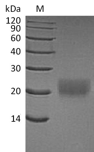 Recombinant Human Cytotoxic T-lymphocyte protein 4(CTLA4),partial (Active)