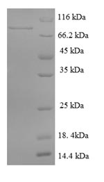 Recombinant Human DENN domain-containing protein 1A(DENND1A) 