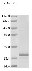 Recombinant Human DET1- and DDB1-associated protein 1(DDA1)