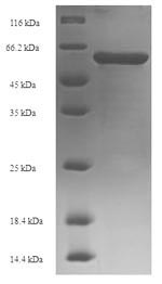 Recombinant Human DNA nucleotidylexotransferase(DNTT)