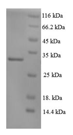 Recombinant Human DNA repair protein complementing XP-C cells(XPC) ,partial