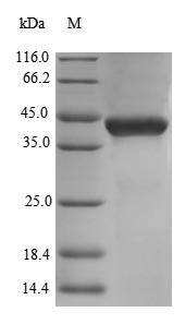 Recombinant Human Decorin(DCN),partial